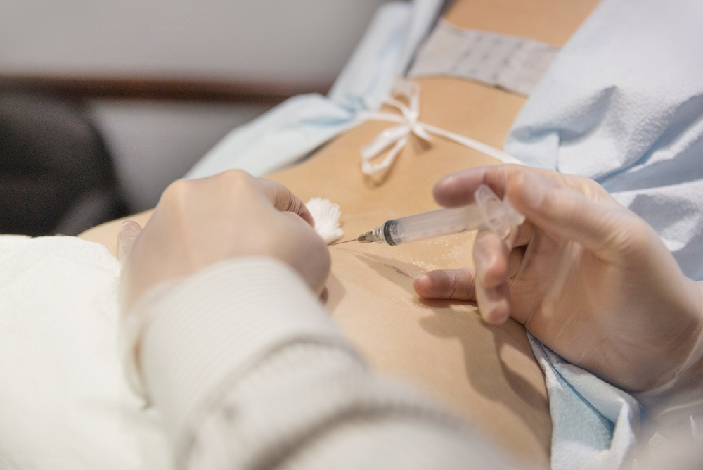Advanced Treatment for the Last Stages of Sciatica